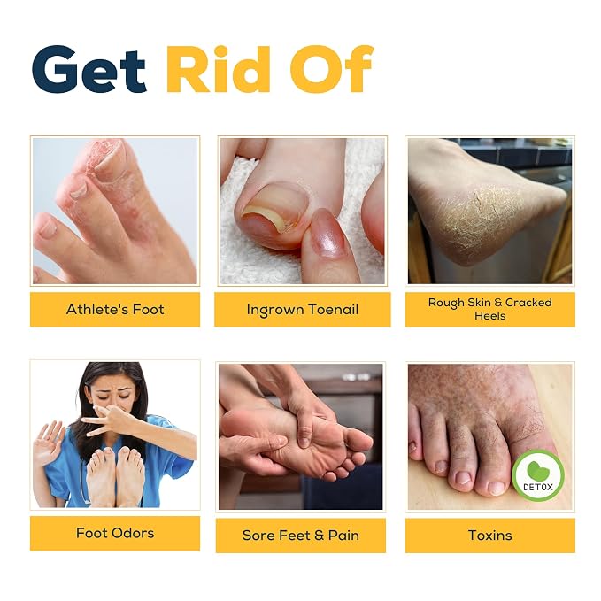 FOOT CURE Citrus Detox Foot Soak - Image 6