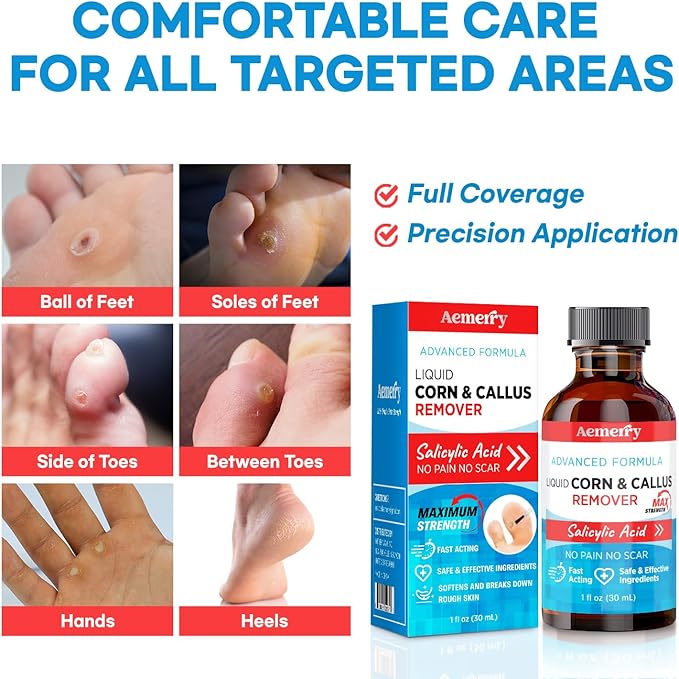 Aemerry Corn Removers for Toes Foot: Liquid Salicylic Acid 17% Corns Calluses - Image 2