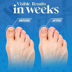 Aromasong Tea Tree Foot Soak - Image 2