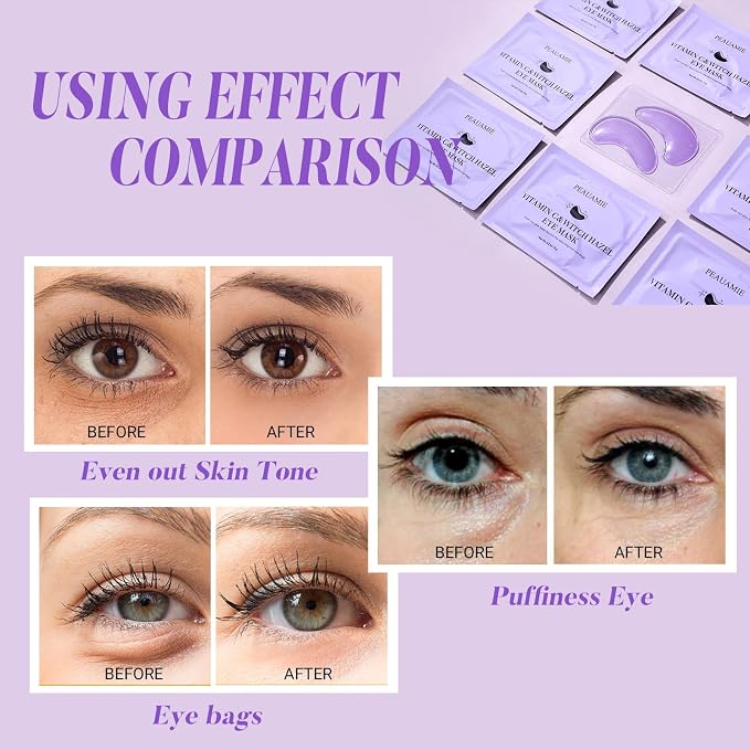 PEAUAMIE Under Eye Patches - Image 6