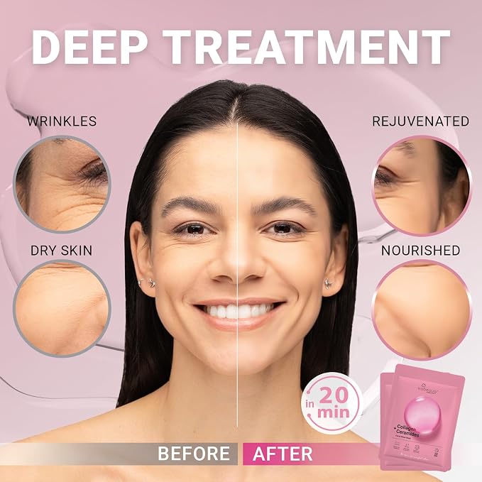 VIABEAUTY 24 Pack of Collagen Face Mask - Image 2