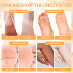 Pedicure Kit Foot Soak Set: Bubble Salt, Sugar Scrub, Massage Mask, Massage - Image 3