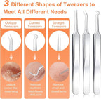 Pimple Popper Tool Kit, IUMAKEVP 15 PCS Professional Stainless Steel Blackhead - Image 2