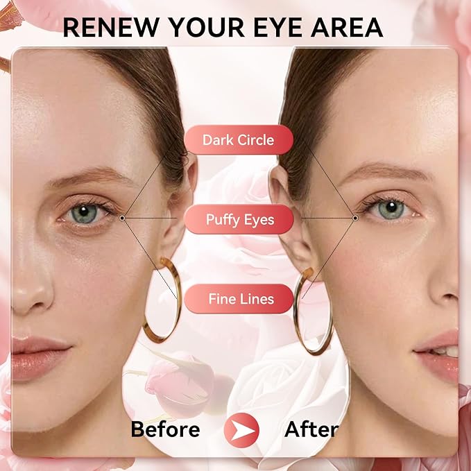 BREYLEE Rose Eye Mask, Under Eye Patches - Image 9