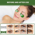Qyiywim Under Eye Patches 70PCS, Under Eye Masks - Image 6