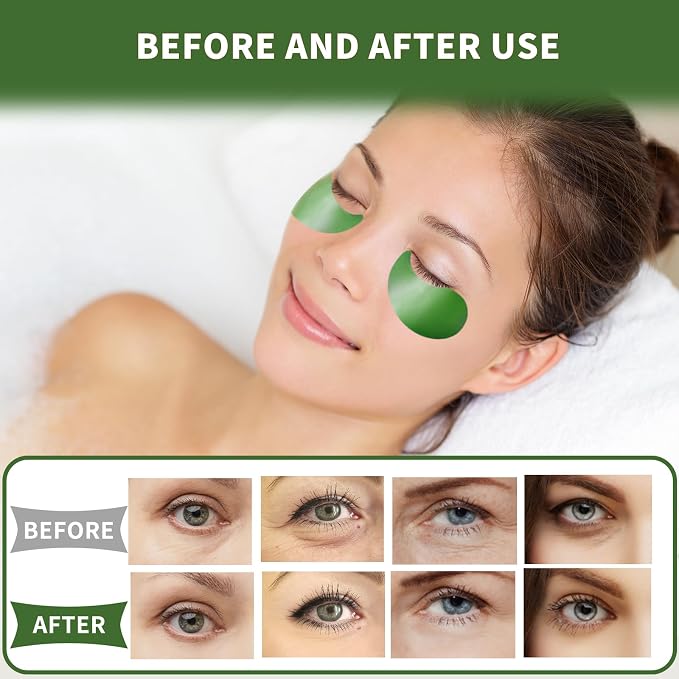 Qyiywim Under Eye Patches 70PCS, Under Eye Masks - Image 6