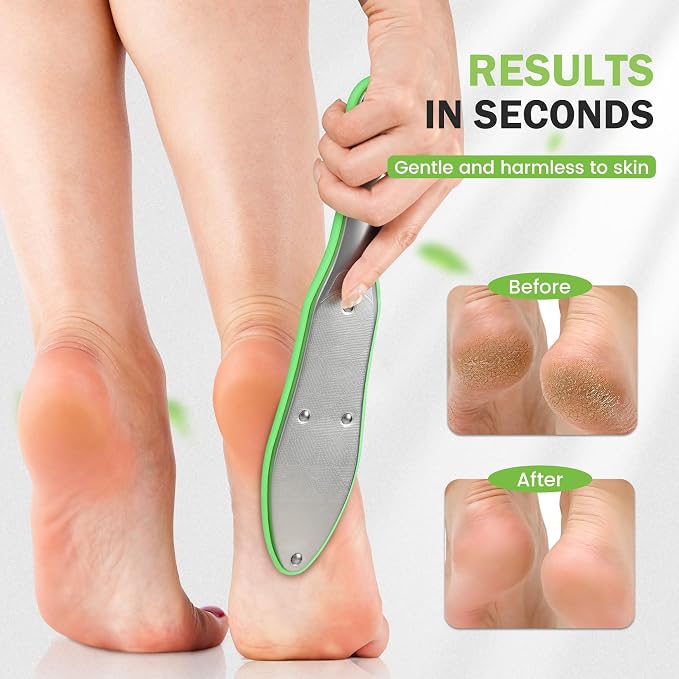 BEZOX Foot Scrubber for Dead Skin - Image 3