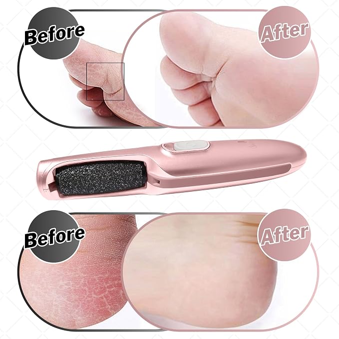 Powerful Electric Callus Remover Wand – Rechargeable Foot File, Grinder & - Image 5