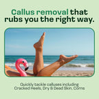 Electric Sole Buffer Foot Callus Remover - Image 2
