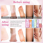 Pedicure Foot Soak Set - Image 3