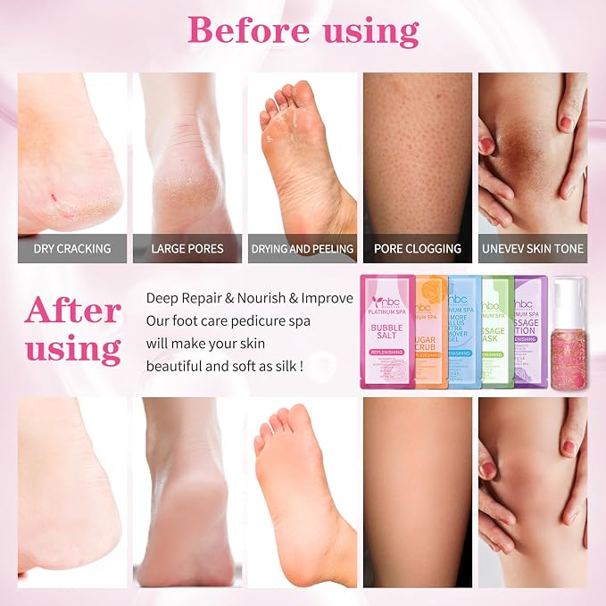 Pedicure Foot Soak Set - Image 3