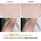 Dr.Melaxin Body Keratin Care Kojic Acid Turmeric Spray - Image 3