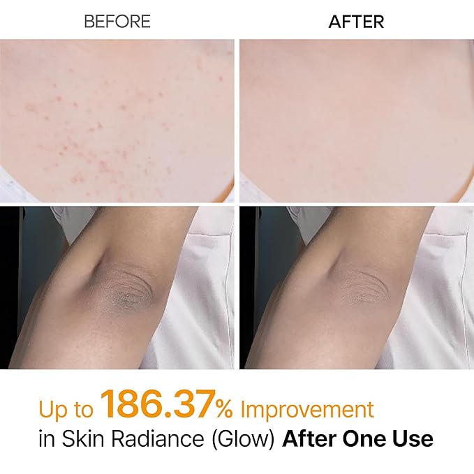 Dr.Melaxin Body Keratin Care Kojic Acid Turmeric Spray - Image 3