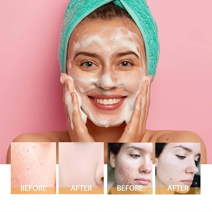 2 Pcs Turmeric Brightening Facial Cleanser, Deep Cleansing Exfoliating Glow - Image 2