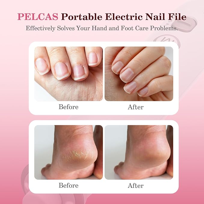 PELCAS Electric Nail File, 10 Speeds Cordless Nail Drill - Image 2