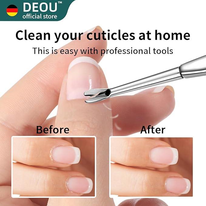 DEOU Cuticle Pusher Dead Skin Remover Stainless Steel dead skin fork cuticle - Image 2