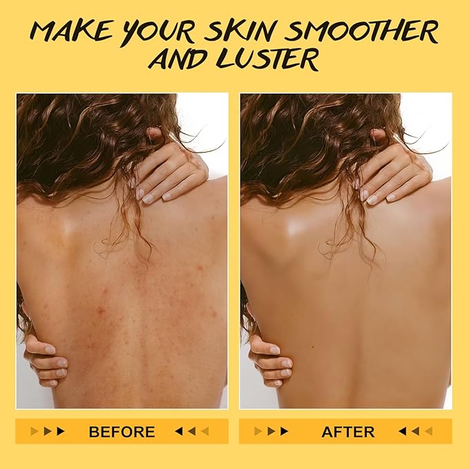POP MODERN.C Turmeric and Vitamin C Body Scrub Remove Dead Skin Improve Dark - Image 4