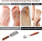Colossal Foot Rasp & Wood Handle Callus Shaver, Pedicure Foot File Kit - Image 5