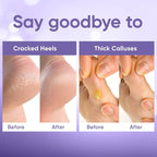 CÉLOR Foot Peeling Mask for Dry Cracked Feet | Foot Mask to Exfoliate Rough - Image 5