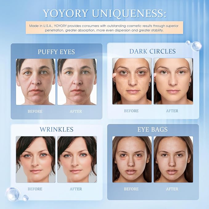 Under Eye Patches Masks - Image 2