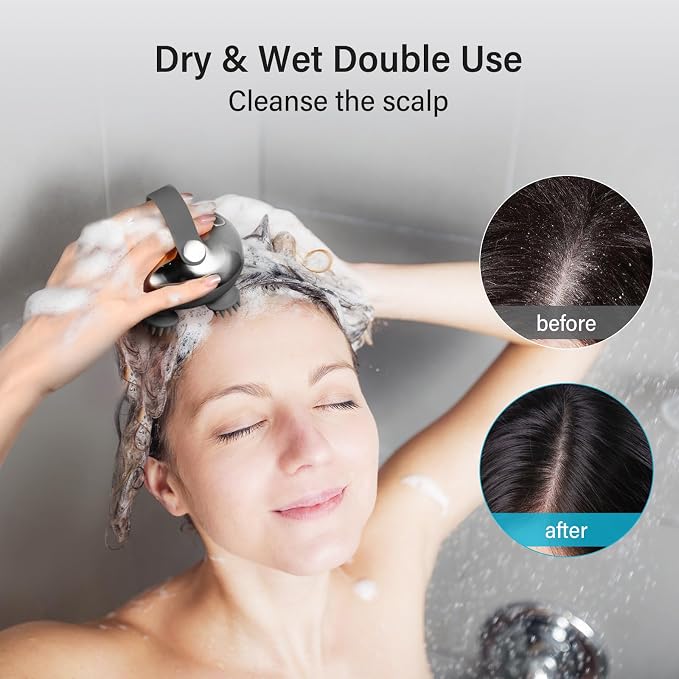 arboleaf Scalp Massager Rechargeable Head Massager Scalp Stress Relax, - Image 3