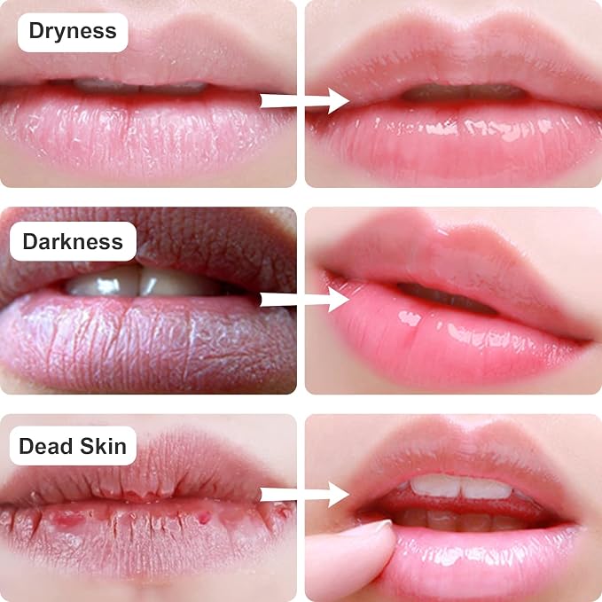 Permotary 30 PCS Collagen Lip Mask Crystal Mouth Care Gel Pads - Image 4