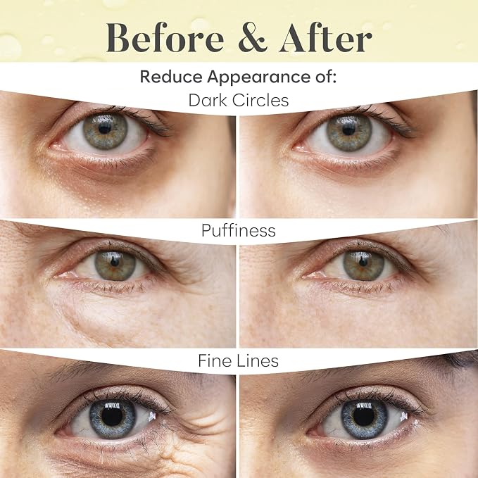 AURAE Green Tea Under Eye Patches - Image 4