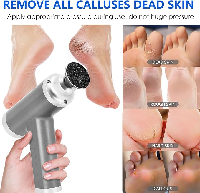 Upgraded Electric Callus Remover - Image 5