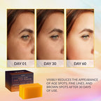 VALITIC Kojic Acid Dark Spot Remover Soap Bars - Image 2