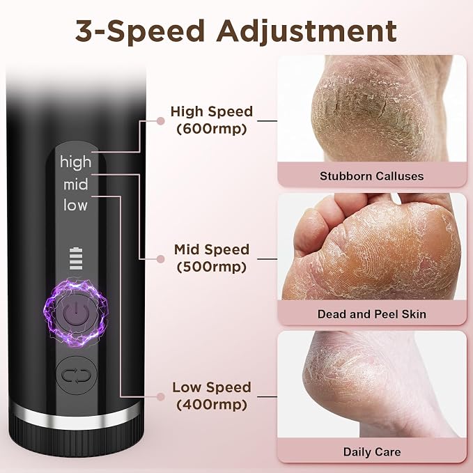 Electric Foot Callus Remover - Image 5