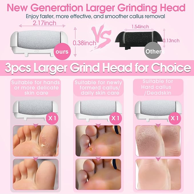 Electric Foot File Callus Remover - Image 3