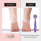 Facón Professional Callus Shaver Remover - Image 3