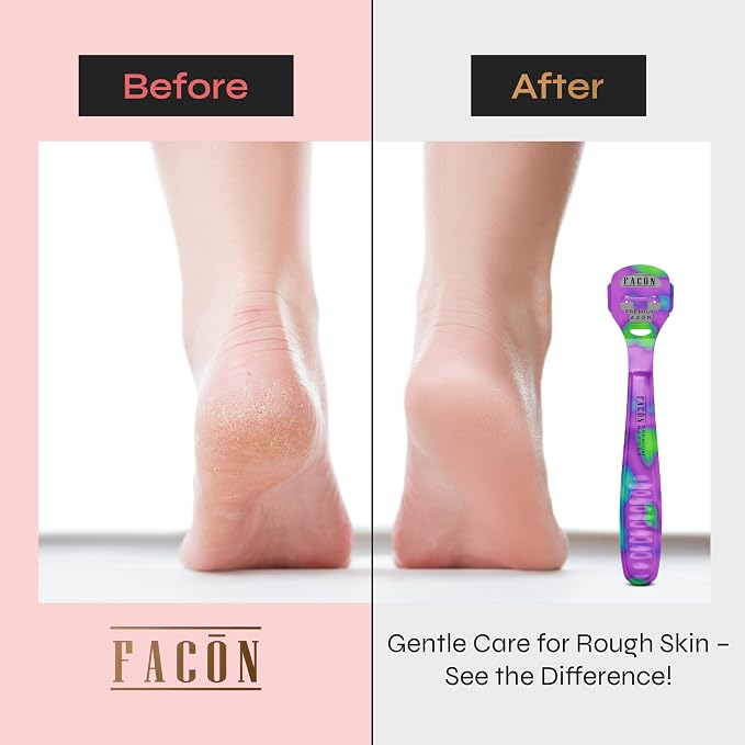 Facón Professional Callus Shaver Remover - Image 3