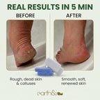 Earth & I Pumice Stone for Feet – 2-Pack Callus Remover | Coarse + Fine - Image 2