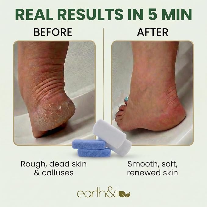Earth & I Pumice Stone for Feet – 2-Pack Callus Remover | Coarse + Fine - Image 2
