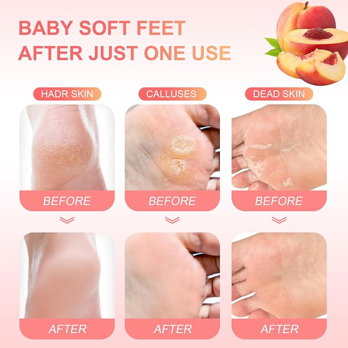 Foot Peeling Mask Exfoliant for Peeling Off Calluses, Natural Exfoliator for - Image 4