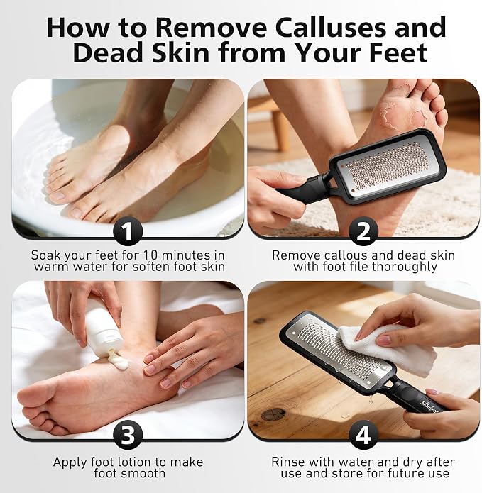 BALUCA Professional Foot File & Callus Remover - Image 8