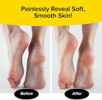 PedEgg Foot File – Traps Shavings Inside - Image 6