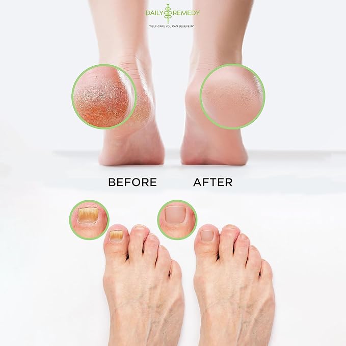 DAILY REMEDY Foot Soak Salts- Variety Pack of 4- Tea Tree Oil, Muscle Relief - Image 5