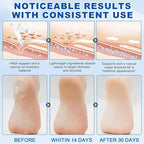60% Urea Foot Cream Stick Plus 2% Salicylic Acid - Image 6
