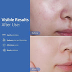 Hicream Glycolic Acid Pads, Dual-Textured Facial Exfoliating Toner - Image 3