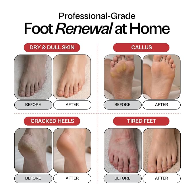 Muscle Soothing Foot Soak with Epsom Salt & Arnica - Image 3
