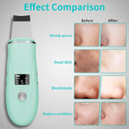 Face Scrubber Skin Spatula - Image 3