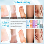 Pedicure Foot Soak Set - Image 3