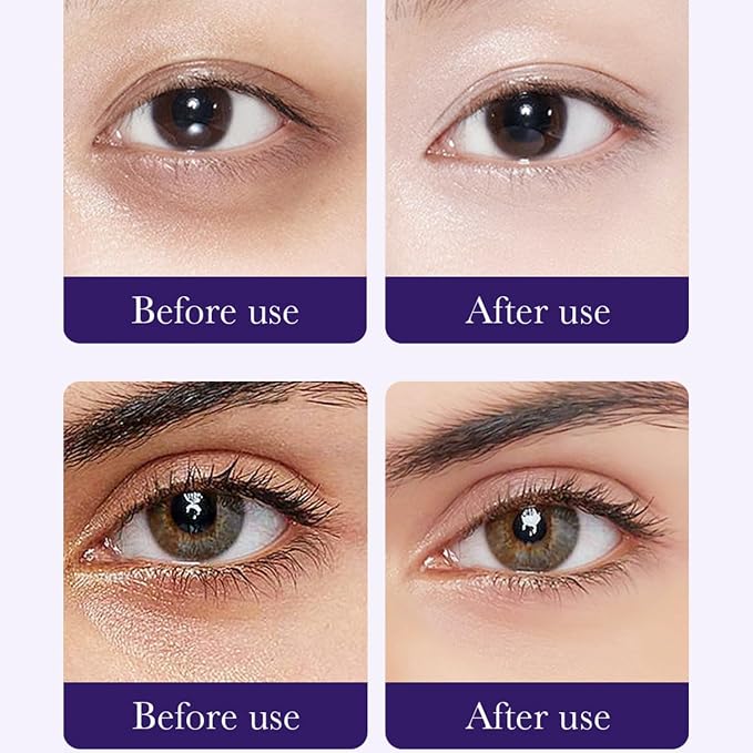 Eakroo Grape Eye Masks - Image 5