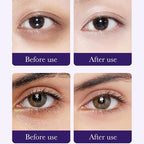 Eakroo Grape Eye Masks - Image 5