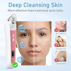 Blackhead Remover Vacuum, USB Interface Type Pore Vacuum, Men and Women Pore - Image 4
