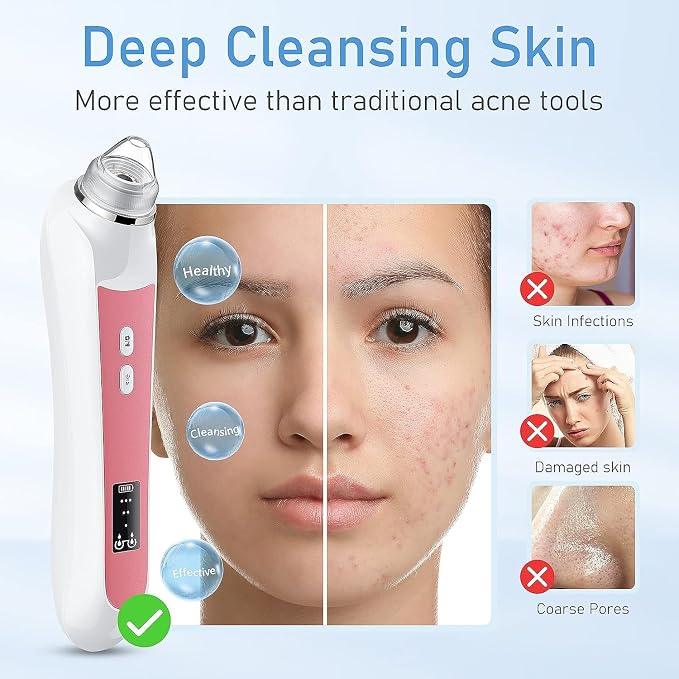 Blackhead Remover Vacuum, USB Interface Type Pore Vacuum, Men and Women Pore - Image 4