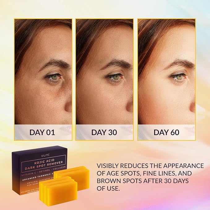 VALITIC Kojic Acid Dark Spot Remover Soap Bars - Image 2