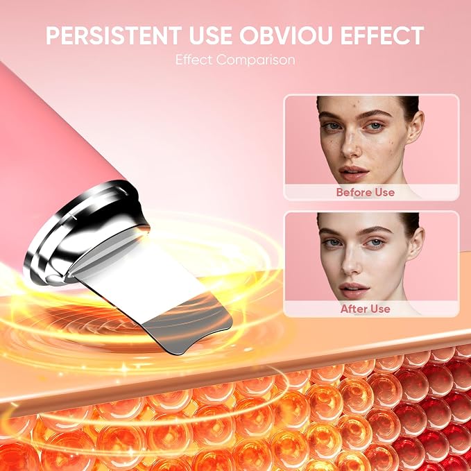 Silicone Face Scrubber Blackhead Scraper Rechargeable 2-in-1 Facial Cleansing - Image 5